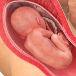 23weeks980