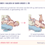 Førstehjelp ved fremmedlegemer i halsen