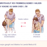Førstehjelp fremmedlegemer i halsen barn over 1 år og voksne