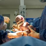 baby-being-born-via-caesarean-section.jpg_s=1024×1024&w=is&k=20&c=WvpAdz9mULydYrzpANXasyMNv8Wcec0taCpAJ9W1gQA=