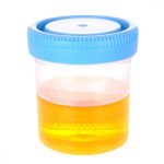 urine-sample-in-a-translucent-cup-on-a-white-background-picture-id186851162