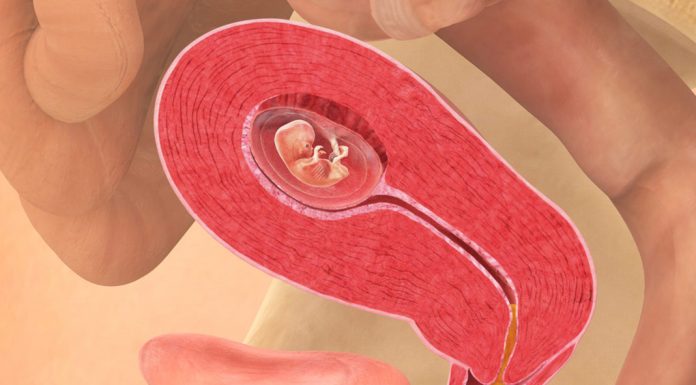 10 uker gravid