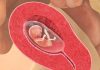 12 uker gravid