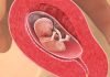 13 uker gravid