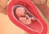15 uker gravid