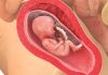 17 uker gravid