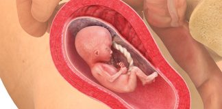 17 uker gravid