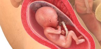 20 uker gravid
