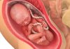 27 uker gravid