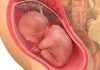 29 uker gravid