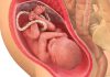 30 uker gravid