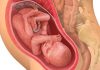 31 uker gravid