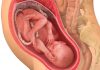 32 uker gravid