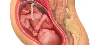 33 uker gravid