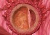 3 uker gravid
