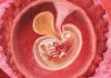 6 uker gravid