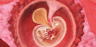 6 uker gravid
