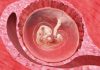 8 uker gravid