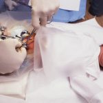 baby-boy-being-circumcised-picture-id174655273