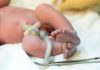 Nyfødt baby med navlesnoren