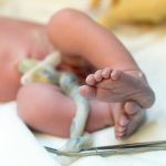 new-born-baby-feet-and-umbilical-cord-picture-id524375536