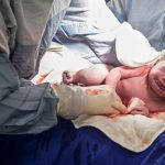 caesarean-section-picture-id579774070