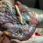 doctor-showing-placenta-picture-id477450518