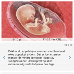 23075C23-50F4-4116-A461-6CDABD2EA68B