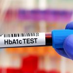 Blood sample for study of HbA1c or Hemoglobin A1c for detection of diabetes