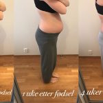 Magebilder_etter_fodsel