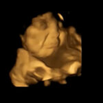 Cry-face reaction scan image