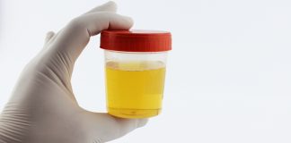 Dette sjekkes urinprøven for når du er gravid