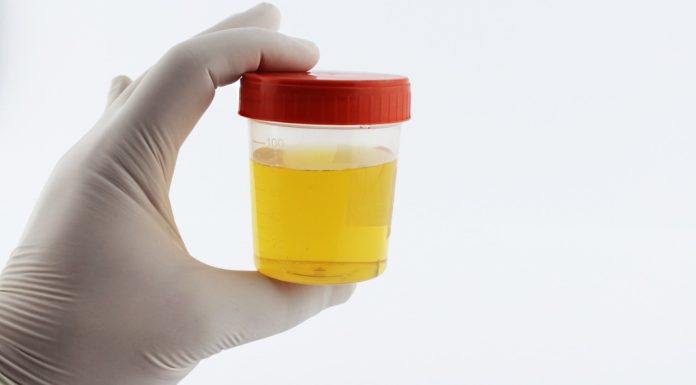 Dette sjekkes urinprøven for når du er gravid